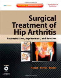 Surgical Treatment of Hip Arthritis: Reconstruction, Replacement, and Revision